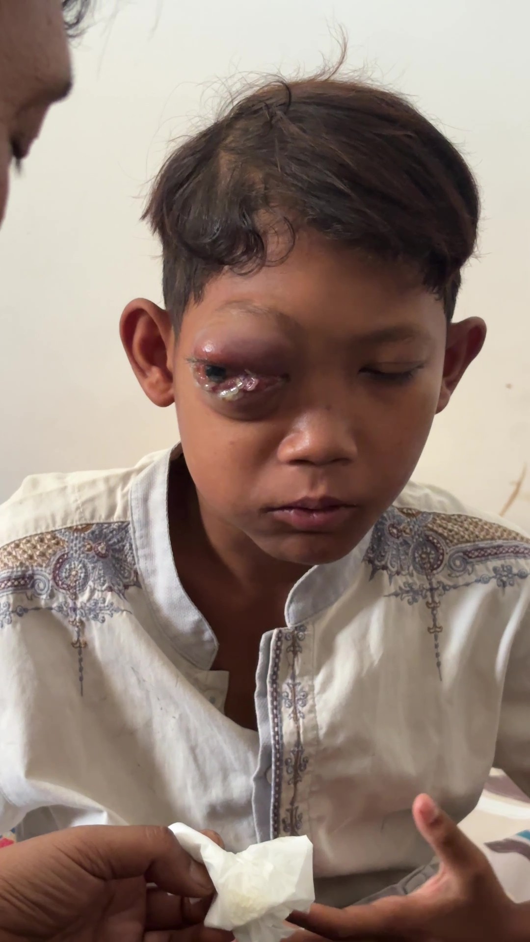 Bantu Teman Indonesia